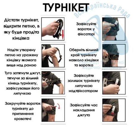 Джгут або турнікет